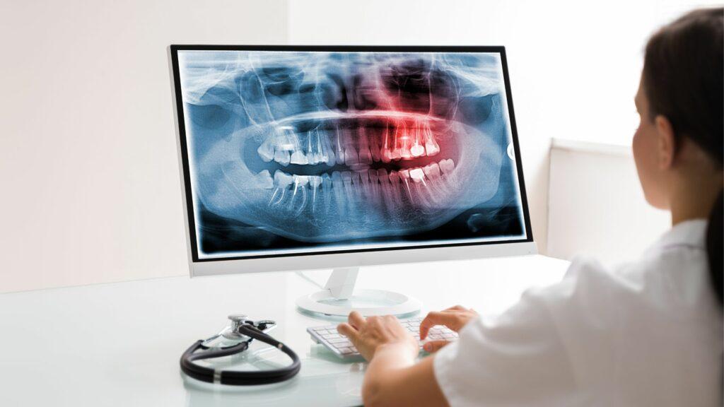 Unlocking Efficiency and Excellence: The Ultimate Buying Guide for Dental Software Solutions