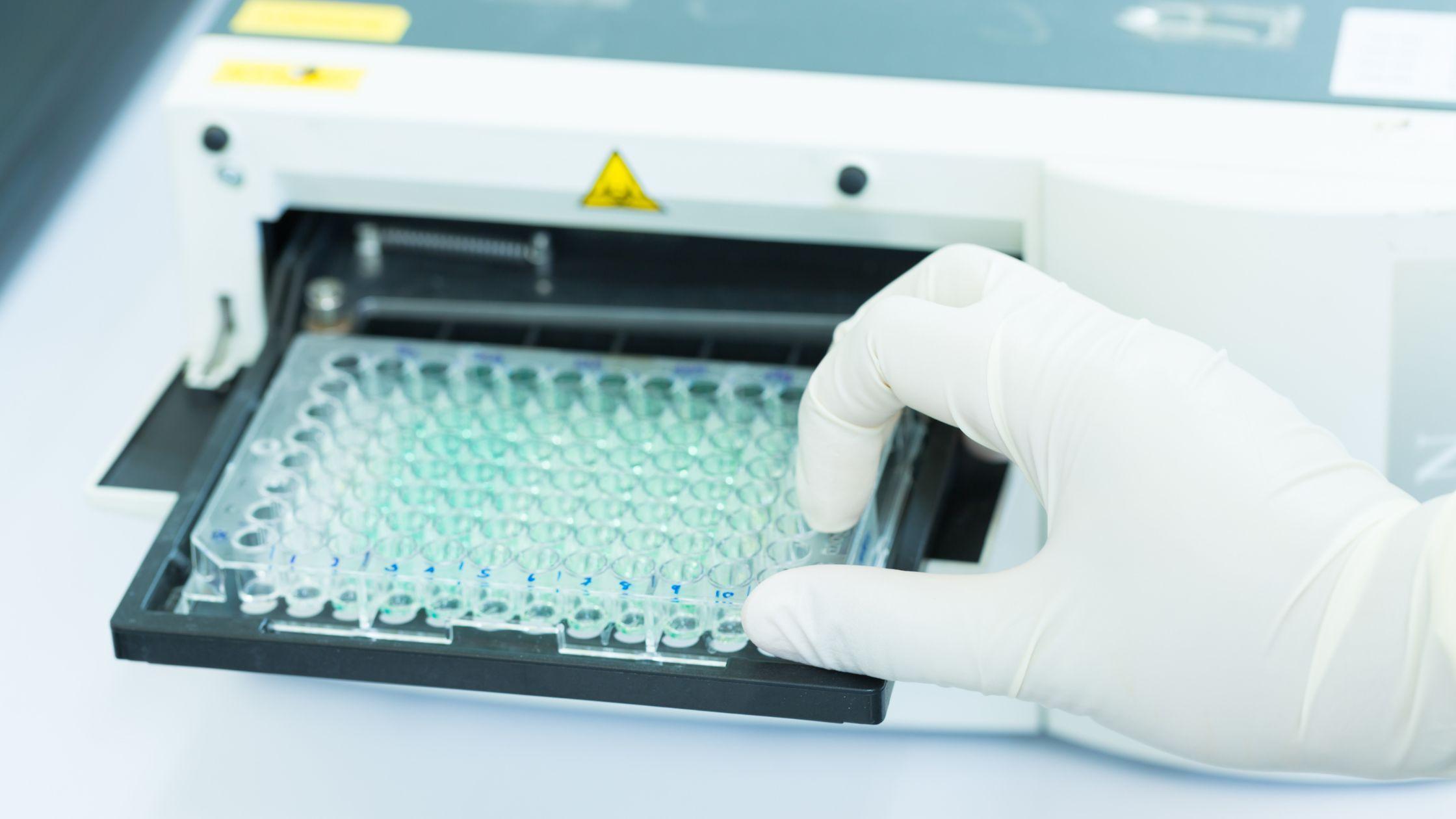 Exploring the Essential Features and Considerations for Selecting an Ideal ELISA Plate Shaker