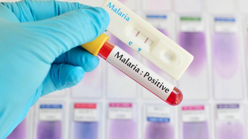 Buying Guide for Malaria Test Kits: Types, Benefits, and Top Manufacturers