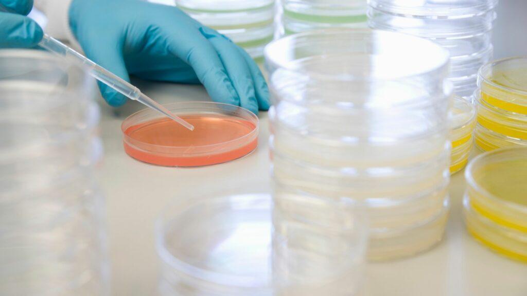 Comprehensive Buying Guide: Choosing the Perfect Petri Dish for Your Laboratory Needs