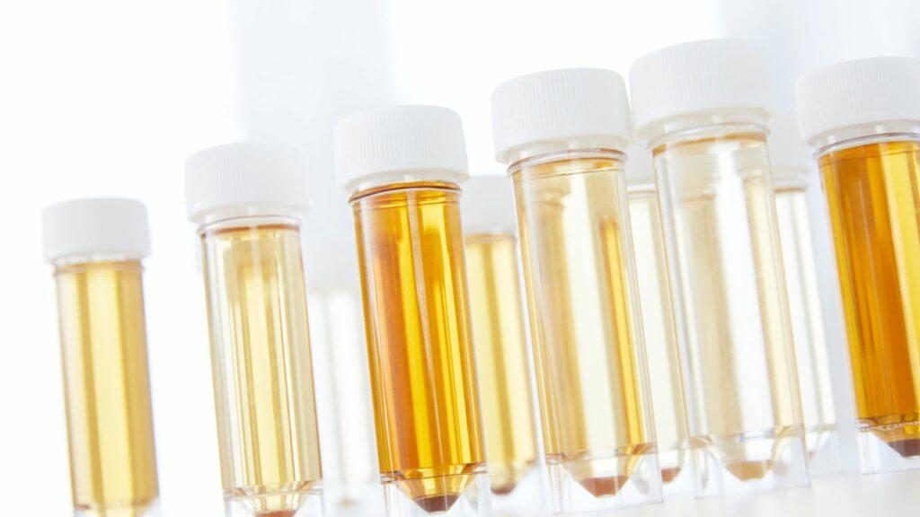 Urine Analyzers: Medical Devices, Automated Testing Equipment, and Advanced Diagnostic Solutions