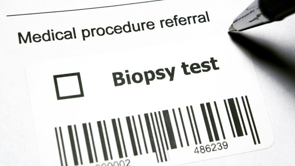 Comprehensive Buying Guide: Choosing the Right Biopsy Punches