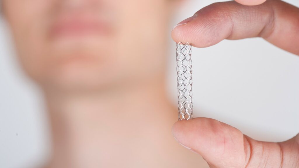 Unlock Optimal Treatment: Your Ultimate Guide to Buying the Right Stent